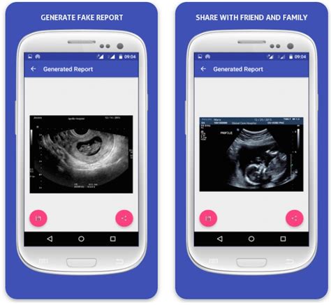 Customize a design from our library of highly-curated free pregnancy announcement templates. . Free fake ultrasound app
